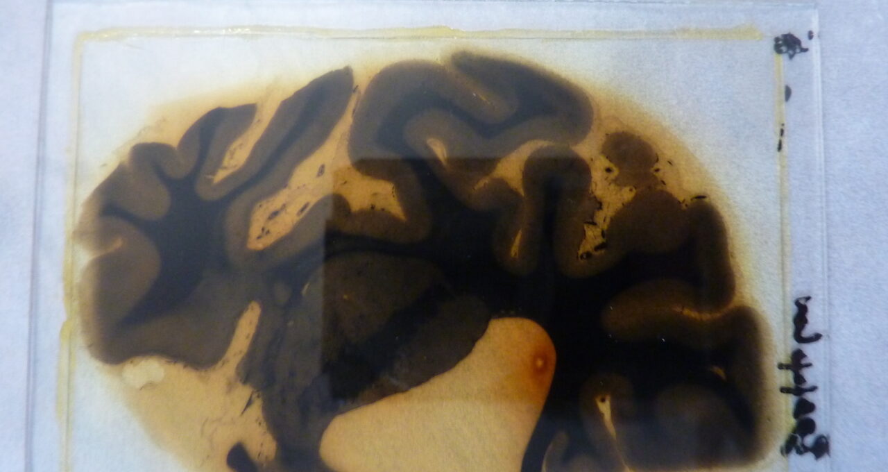 Weindling-Slice-of-Brain-web